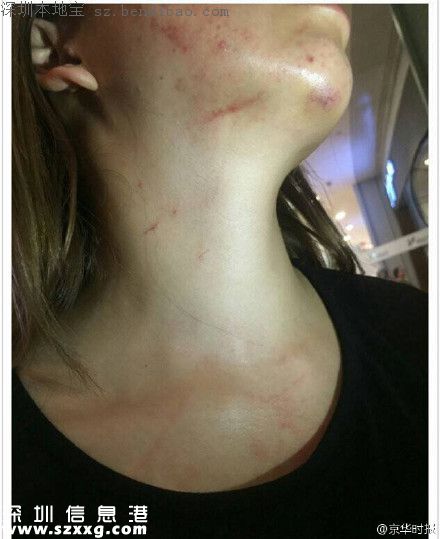 深圳女子称报案被殴打 警察回应酒后辱骂民警